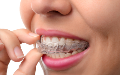 woman holding invisalign clear braces